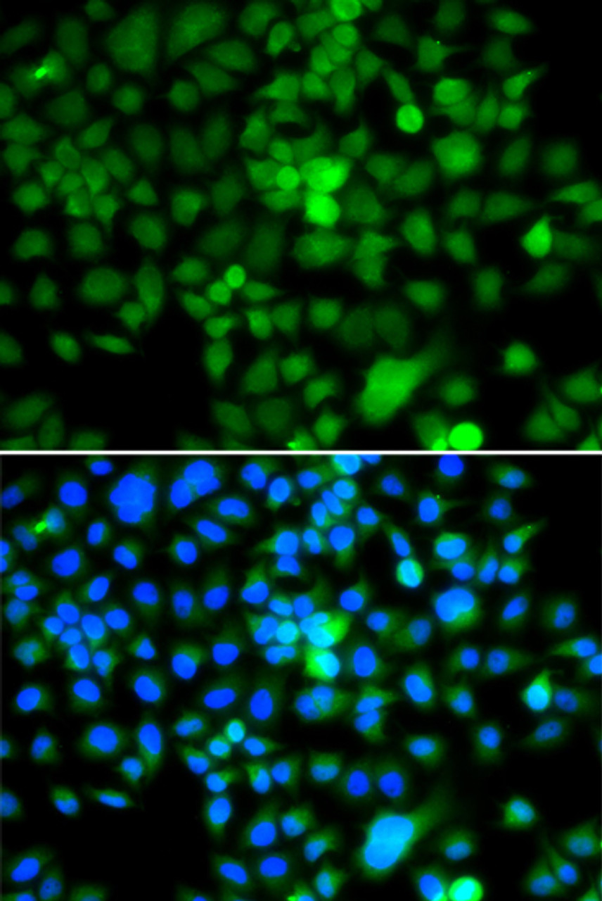 Immunofluorescence analysis of A549 cells using NAP1L3 antibody (22-779) . Blue: DAPI for nuclear staining.