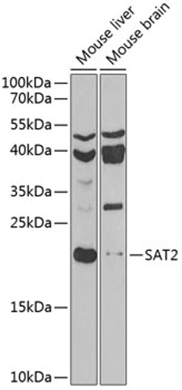 Western blot analysis of extracts of various cell lines, using SAT2 antibody (22-787) at 1:1000 dilution.<br/>Secondary antibody: HRP Goat Anti-Rabbit IgG (H+L) at 1:10000 dilution.<br/>Lysates/proteins: 25ug per lane.<br/>Blocking buffer: 3% nonfat dry milk in TBST.<br/>Detection: ECL Basic Kit.<br/>Exposure time: 90s.