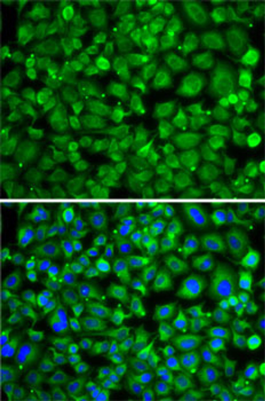 Immunofluorescence analysis of A-549 cells using SAT2 antibody (22-787) . Blue: DAPI for nuclear staining.