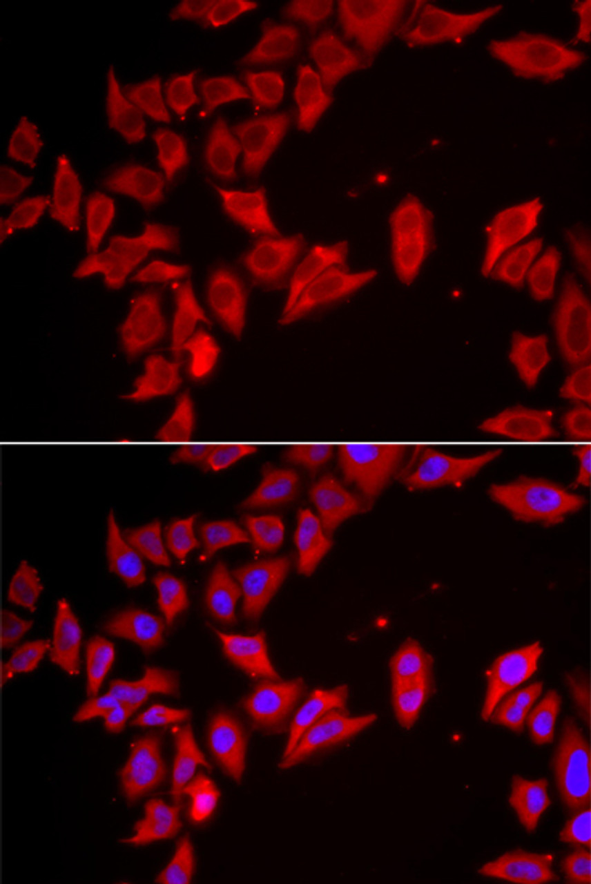 Immunofluorescence analysis of HeLa cells using SLC35A2 antibody (22-801) . Blue: DAPI for nuclear staining.