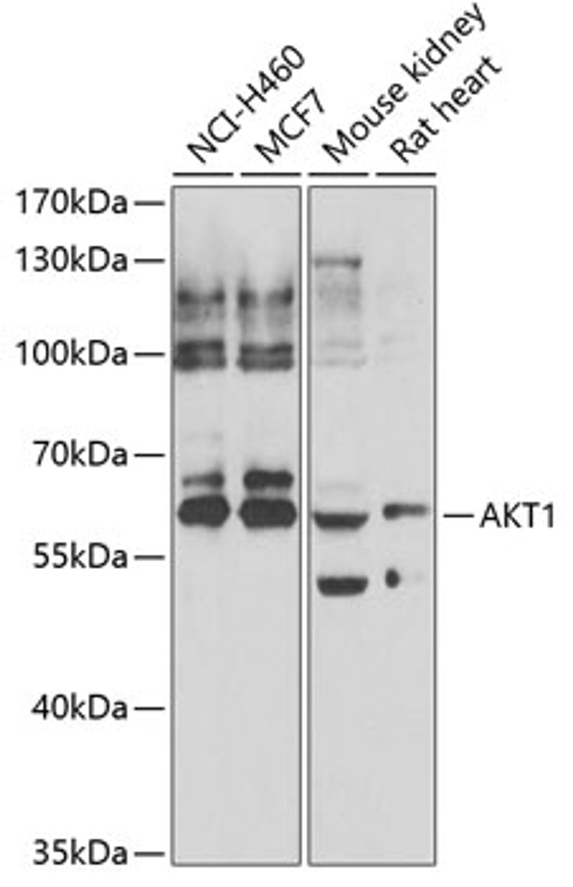 Western blot analysis of extracts of various cell lines, using AKT1 antibody (22-824) .<br/>Secondary antibody: HRP Goat Anti-Rabbit IgG (H+L) at 1:10000 dilution.<br/>Lysates/proteins: 25ug per lane.<br/>Blocking buffer: 3% nonfat dry milk in TBST.<br/>Detection: ECL Enhanced Kit.<br/>Exposure time: 30s.