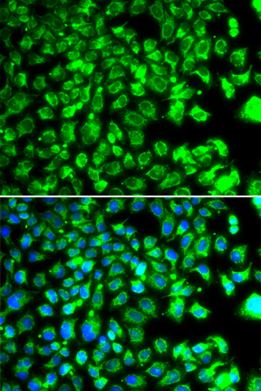 Immunofluorescence analysis of MCF-7 cells using C10orf32 antibody (22-829) . Blue: DAPI for nuclear staining.