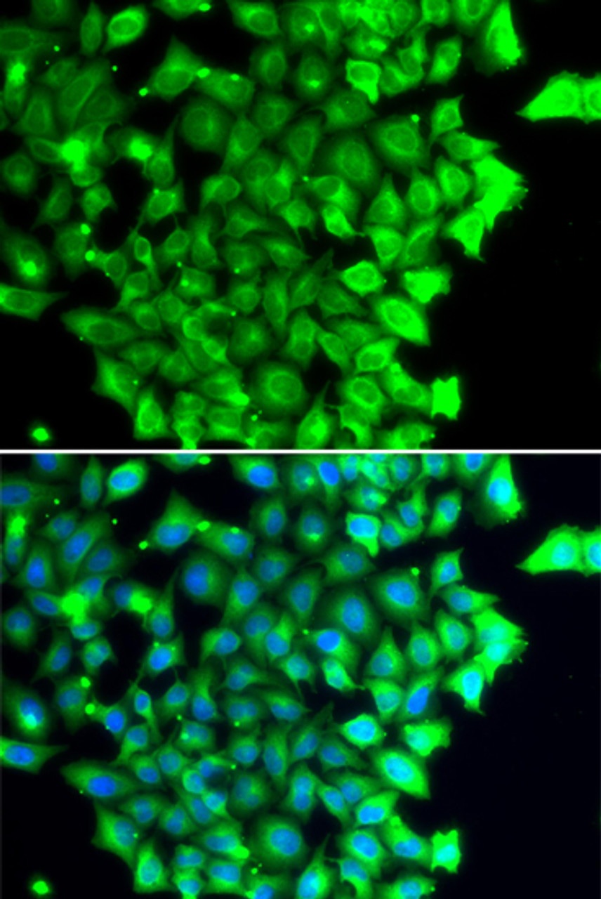 Immunofluorescence analysis of MCF-7 cells using TRIAP1 antibody (22-855) . Blue: DAPI for nuclear staining.