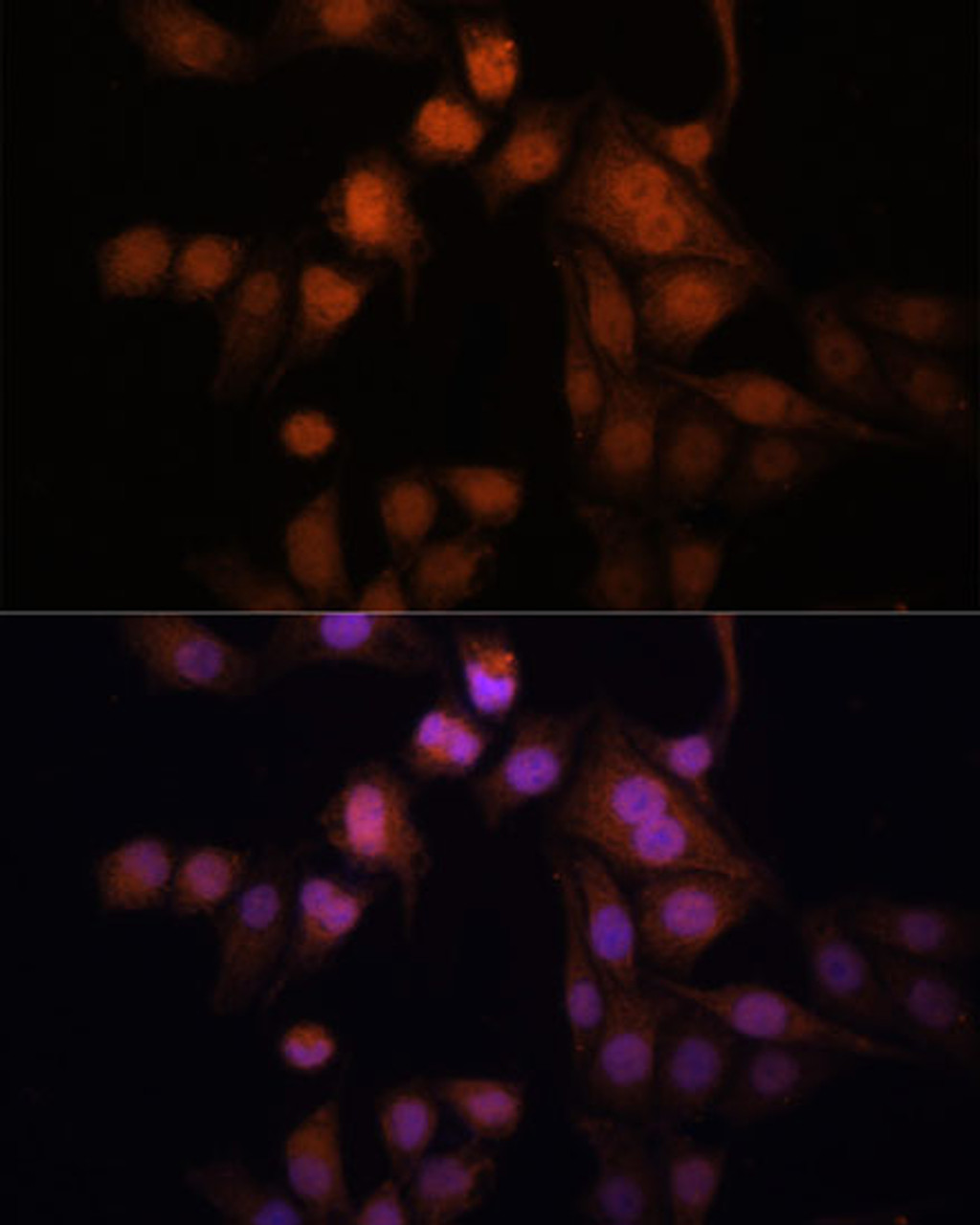Immunofluorescence analysis of HeLa cells using TWIST1 antibody (22-856) at dilution of 1:100. Blue: DAPI for nuclear staining.
