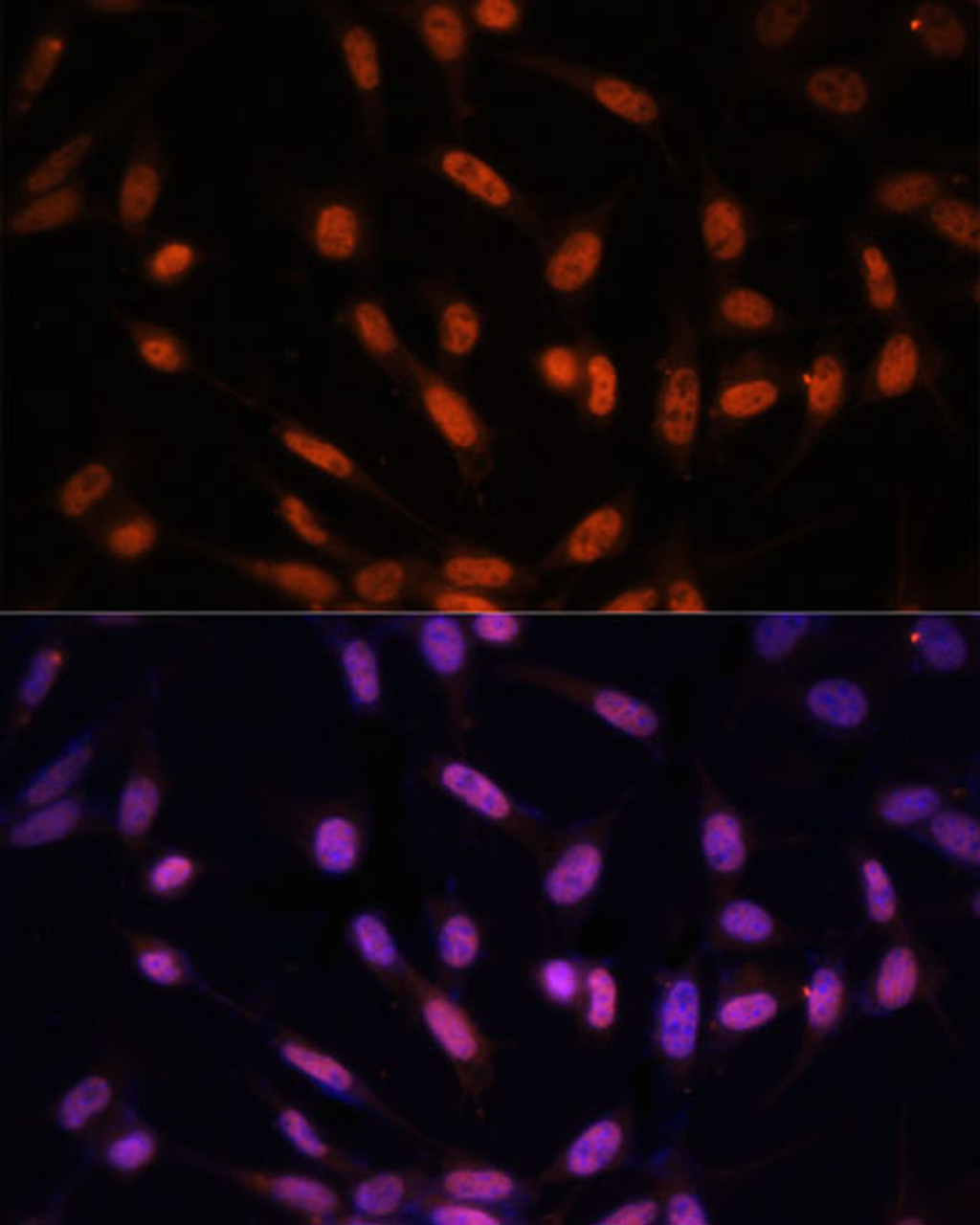 Immunofluorescence analysis of NIH/3T3 cells using TWIST1 antibody (22-856) at dilution of 1:100. Blue: DAPI for nuclear staining.