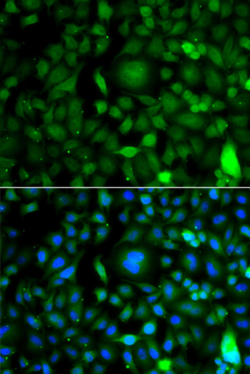 Immunofluorescence analysis of A549 cells using DPF1 antibody (22-883) . Blue: DAPI for nuclear staining.