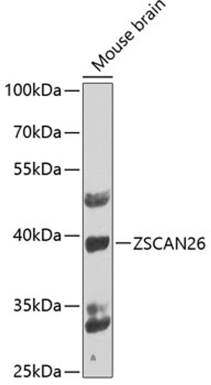 Western blot analysis of extracts of mouse brain, using ZSCAN26 antibody (23-034) at 1:1000 dilution.<br/>Secondary antibody: HRP Goat Anti-Rabbit IgG (H+L) at 1:10000 dilution.<br/>Lysates/proteins: 25ug per lane.<br/>Blocking buffer: 3% nonfat dry milk in TBST.<br/>Detection: ECL Basic Kit.<br/>Exposure time: 90s.