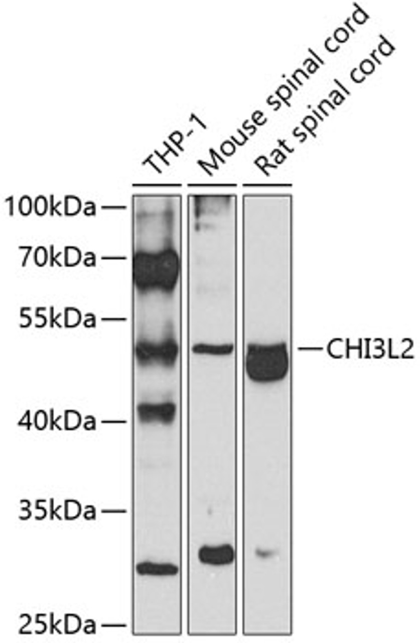 Western blot analysis of extracts of various cell lines, using CHI3L2 antibody (23-084) at 1:1000 dilution._Secondary antibody: HRP Goat Anti-Rabbit IgG (H+L) at 1:10000 dilution._Lysates/proteins: 25ug per lane._Blocking buffer: 3% nonfat dry milk in TBST._Detection: ECL Basic Kit._Exposure time: 90s.