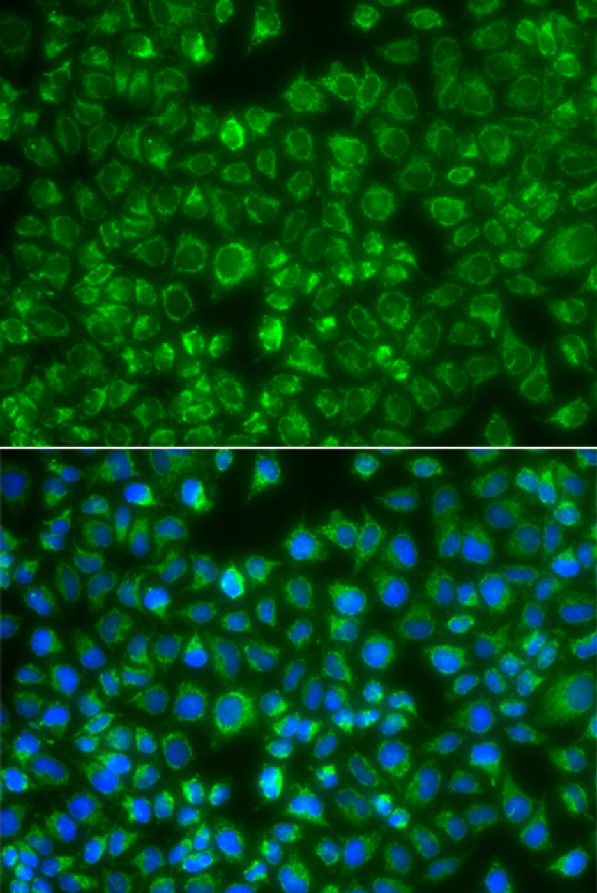 Immunofluorescence analysis of A549 cells using MTMR4 antibody (23-165) . Blue: DAPI for nuclear staining.