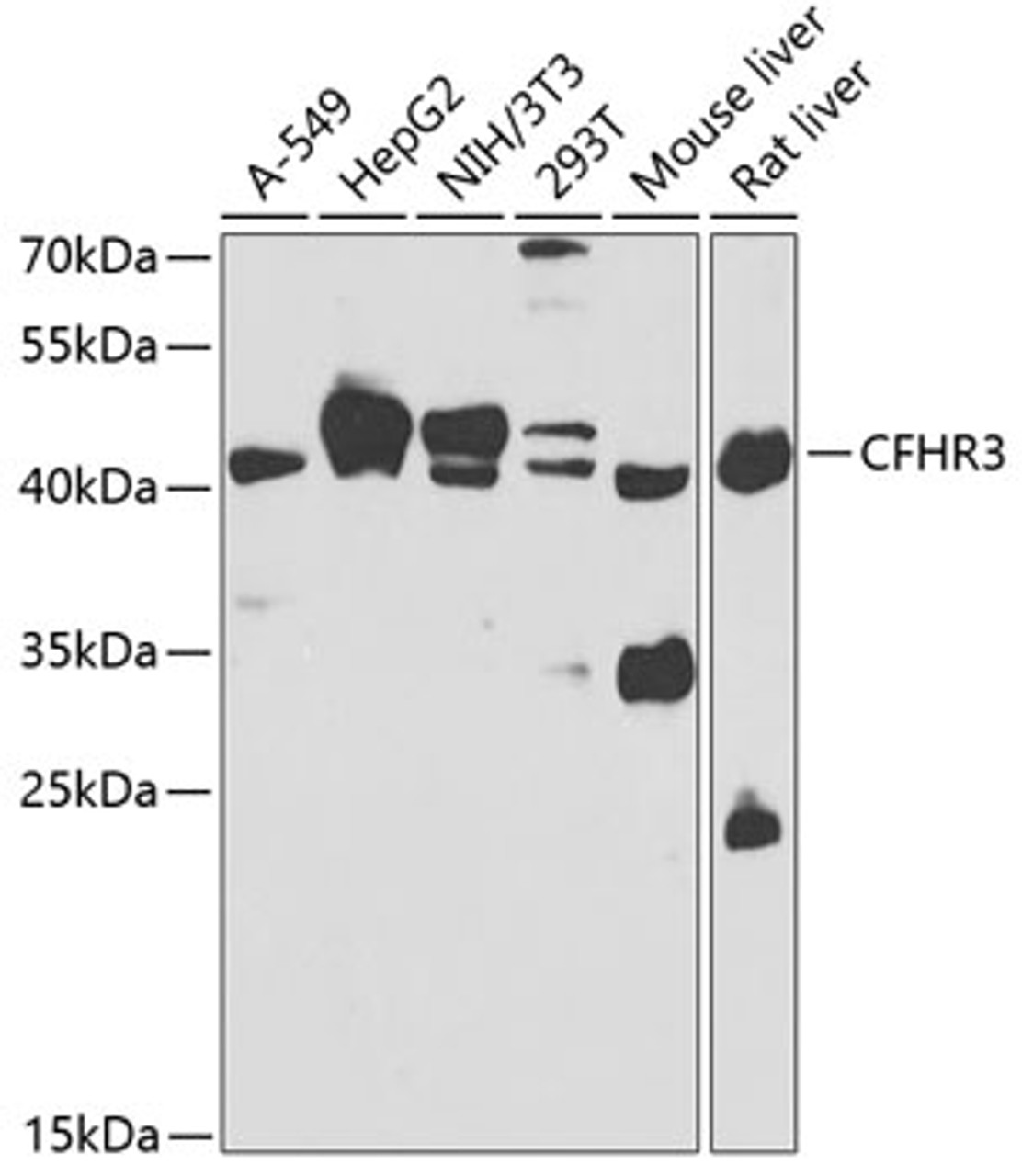 Western blot analysis of extracts of various cell lines, using CFHR3 antibody (23-176) at 1:1000 dilution.<br/>Secondary antibody: HRP Goat Anti-Rabbit IgG (H+L) at 1:10000 dilution.<br/>Lysates/proteins: 25ug per lane.<br/>Blocking buffer: 3% nonfat dry milk in TBST.<br/>Detection: ECL Basic Kit.<br/>Exposure time: 90s.
