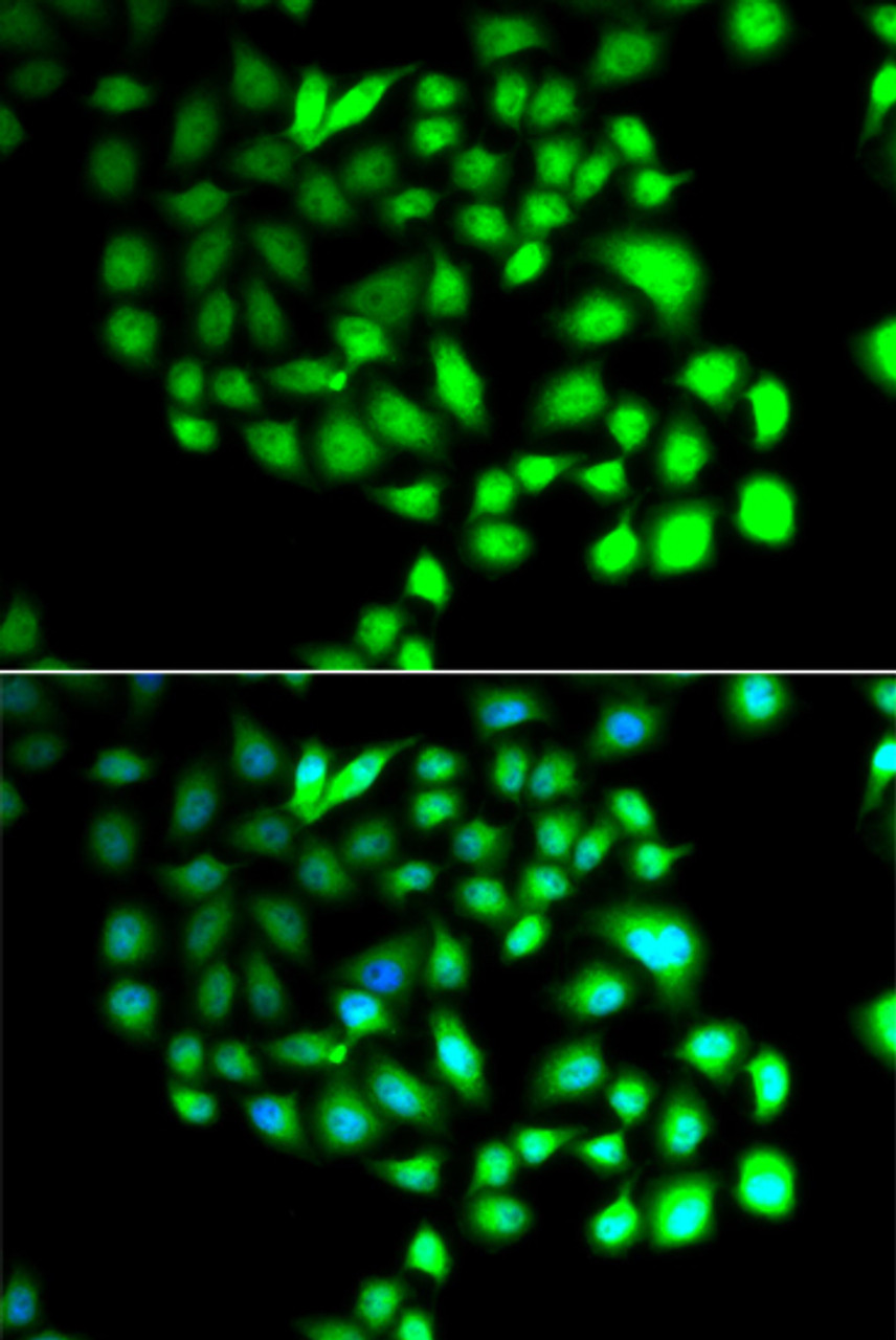 Immunofluorescence analysis of A549 cells using TCEAL8 antibody (23-223) . Blue: DAPI for nuclear staining.