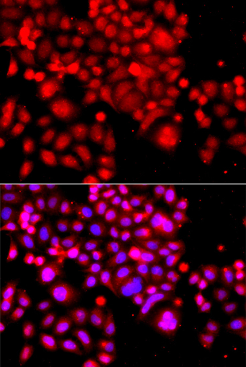 Immunofluorescence analysis of A549 cells using ASCC3 antibody (23-311) . Blue: DAPI for nuclear staining.