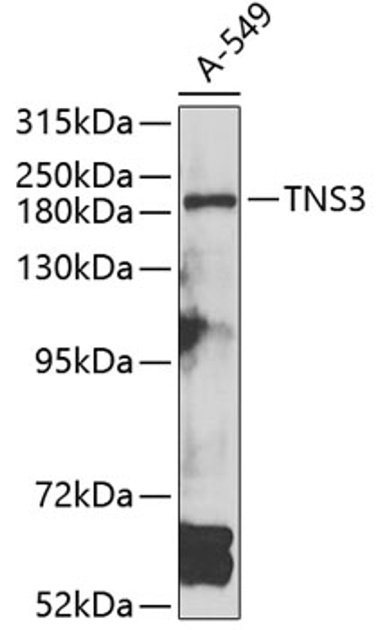 Western blot analysis of extracts of A-549 cells, using TNS3 antibody (23-335) at 1:1000 dilution.<br/>Secondary antibody: HRP Goat Anti-Rabbit IgG (H+L) at 1:10000 dilution.<br/>Lysates/proteins: 25ug per lane.<br/>Blocking buffer: 3% nonfat dry milk in TBST.<br/>Detection: ECL Basic Kit.<br/>Exposure time: 90s.
