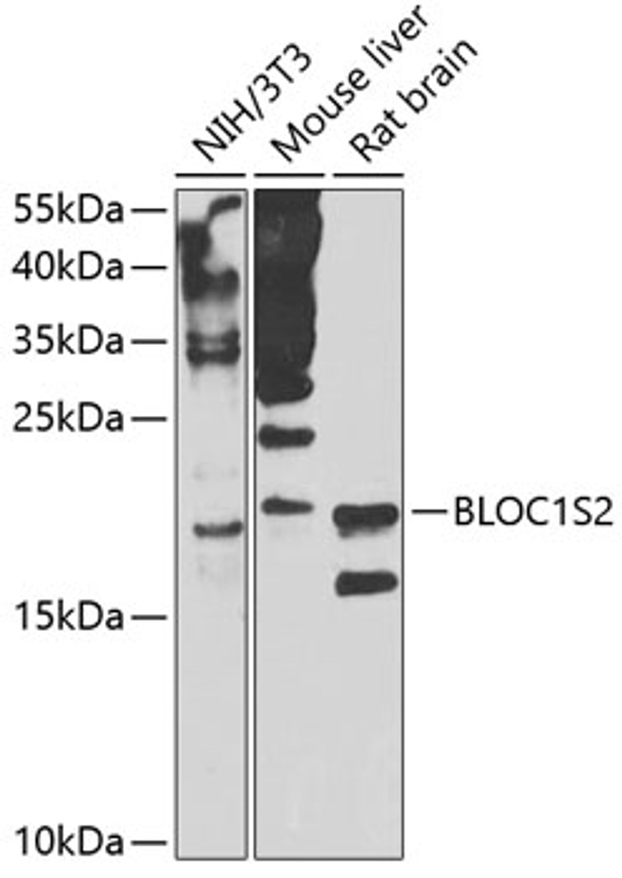 Western blot analysis of extracts of various cell lines, using BLOC1S2 antibody (23-347) at 1:1000 dilution._Secondary antibody: HRP Goat Anti-Rabbit IgG (H+L) at 1:10000 dilution._Lysates/proteins: 25ug per lane._Blocking buffer: 3% nonfat dry milk in TBST._Detection: ECL Enhanced Kit._Exposure time: 30s.