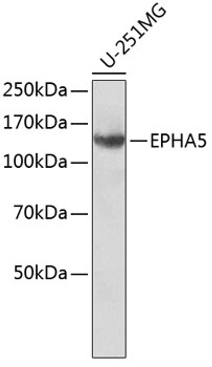 Western blot analysis of extracts of U-251MG cells, using EPHA5 antibody (23-361) .<br/>Secondary antibody: HRP Goat Anti-Mouse IgG (H+L) (AS003) at 1:10000 dilution.<br/>Lysates/proteins: 25ug per lane.<br/>Blocking buffer: 3% nonfat dry milk in TBST.