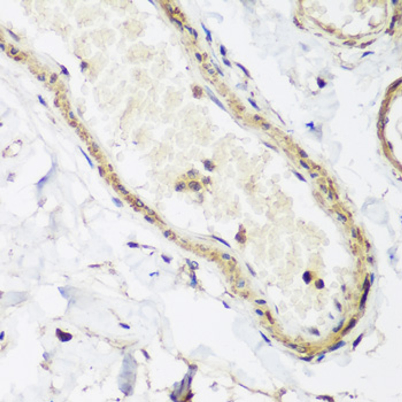 Immunohistochemistry of paraffin-embedded human colon using CAV3 antibody (23-393) at dilution of 1:200 (40x lens) .