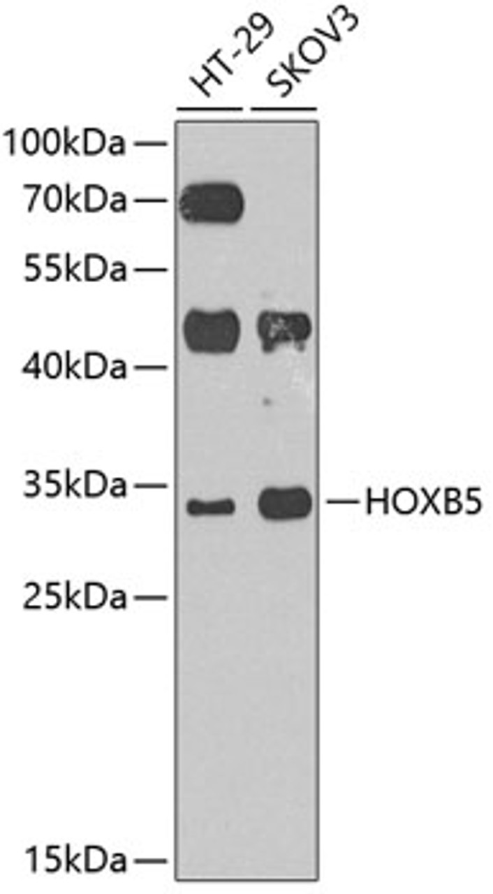 Western blot analysis of extracts of various cell lines, using HOXB5 antibody (23-415) at 1:1000 dilution.<br/>Secondary antibody: HRP Goat Anti-Rabbit IgG (H+L) at 1:10000 dilution.<br/>Lysates/proteins: 25ug per lane.<br/>Blocking buffer: 3% nonfat dry milk in TBST.<br/>Detection: ECL Enhanced Kit.<br/>Exposure time: 90s.