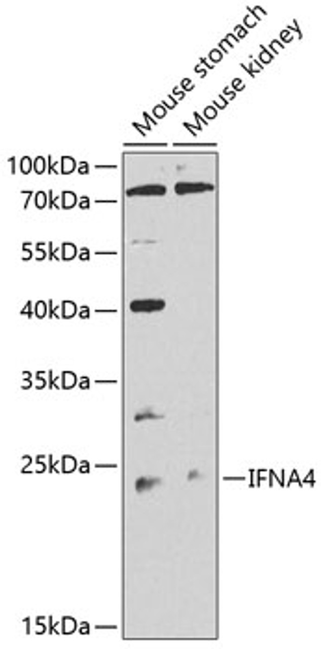 Western blot analysis of extracts of various cell lines, using IFNA4 antibody (23-416) at 1:1000 dilution.<br/>Secondary antibody: HRP Goat Anti-Rabbit IgG (H+L) at 1:10000 dilution.<br/>Lysates/proteins: 25ug per lane.<br/>Blocking buffer: 3% nonfat dry milk in TBST.<br/>Detection: ECL Enhanced Kit.<br/>Exposure time: 20s.