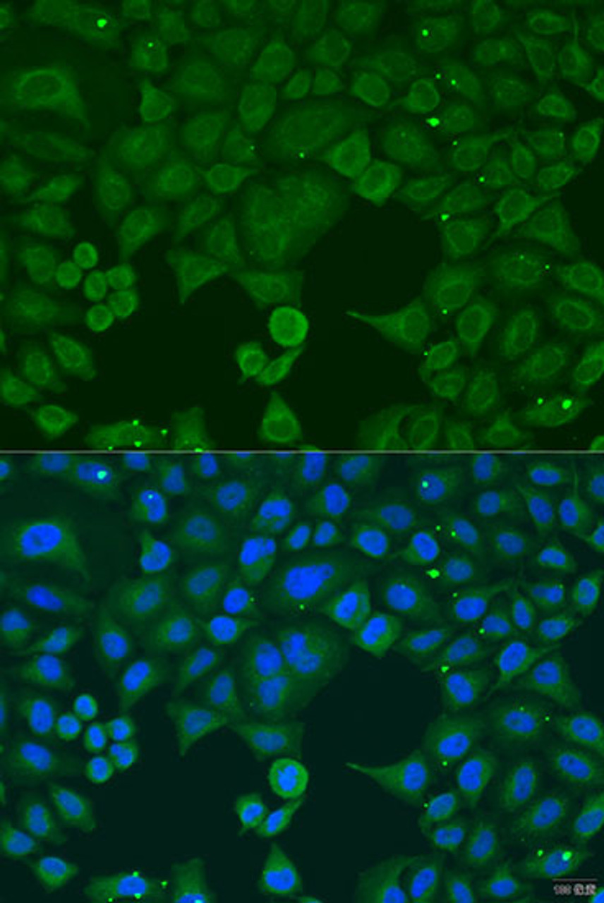 Immunofluorescence analysis of U2OS cells using IFNA4 antibody (23-416) at dilution of 1:100. Blue: DAPI for nuclear staining.