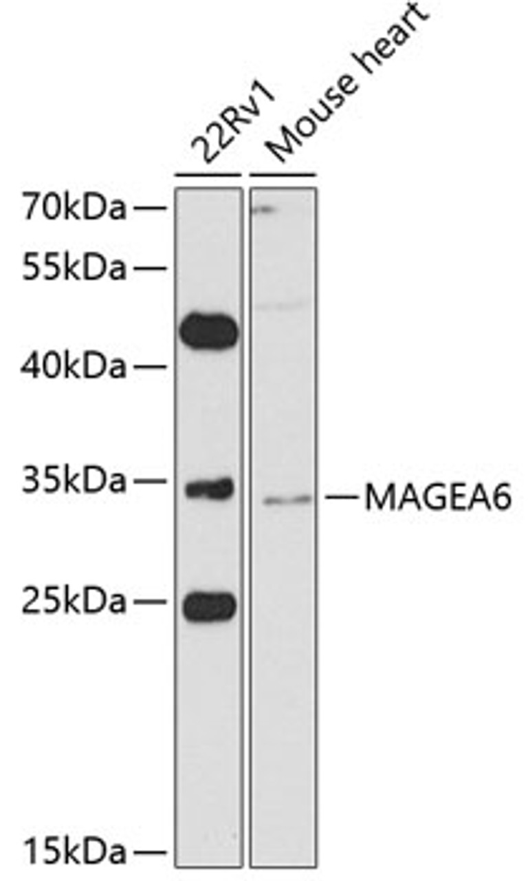 Western blot analysis of extracts of various cell lines, using MAGEA6 antibody (23-419) at 1:1000 dilution.<br/>Secondary antibody: HRP Goat Anti-Rabbit IgG (H+L) at 1:10000 dilution.<br/>Lysates/proteins: 25ug per lane.<br/>Blocking buffer: 3% nonfat dry milk in TBST.<br/>Detection: ECL Basic Kit.<br/>Exposure time: 90s.