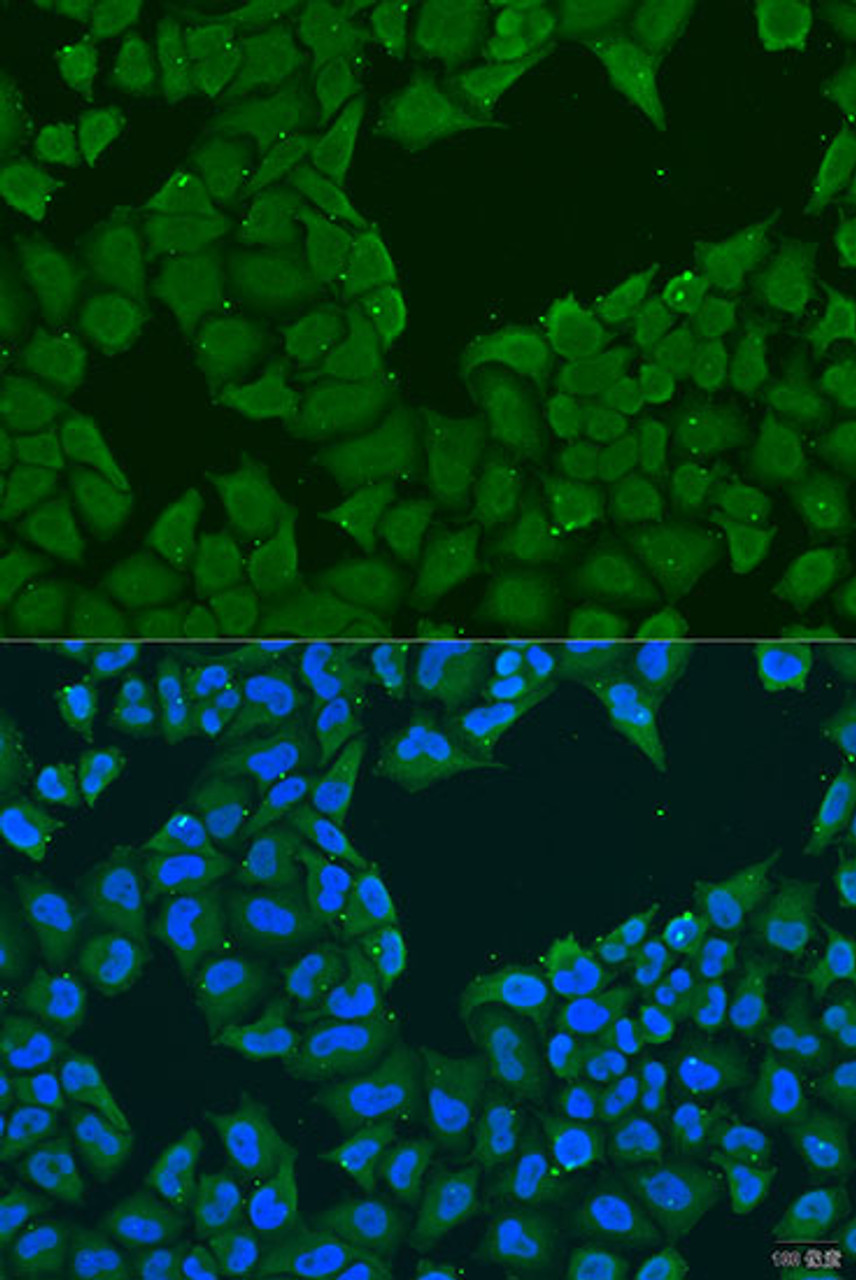 Immunofluorescence analysis of U2OS cells using MAGEA6 antibody (23-419) at dilution of 1:100. Blue: DAPI for nuclear staining.
