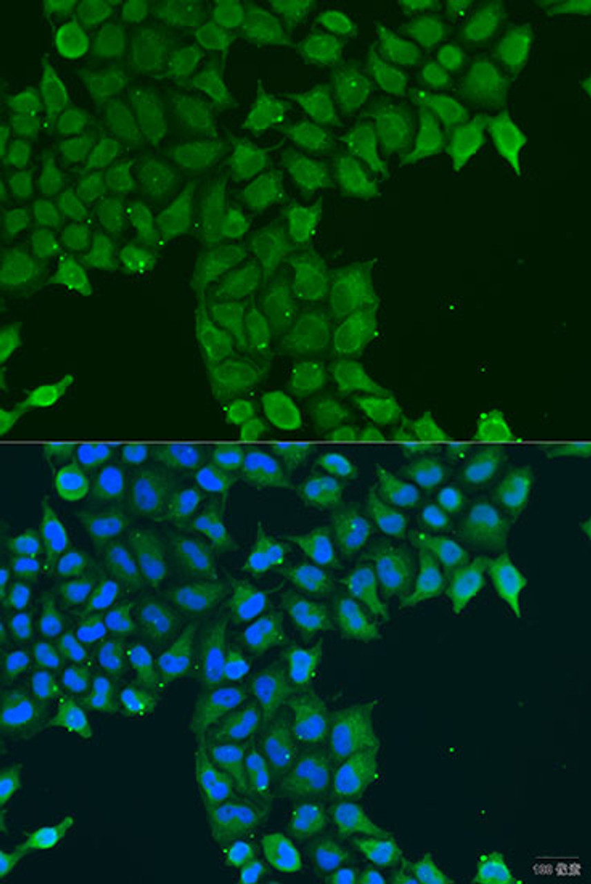 Immunofluorescence analysis of U2OS cells using CDK16 antibody (23-427) at dilution of 1:100. Blue: DAPI for nuclear staining.