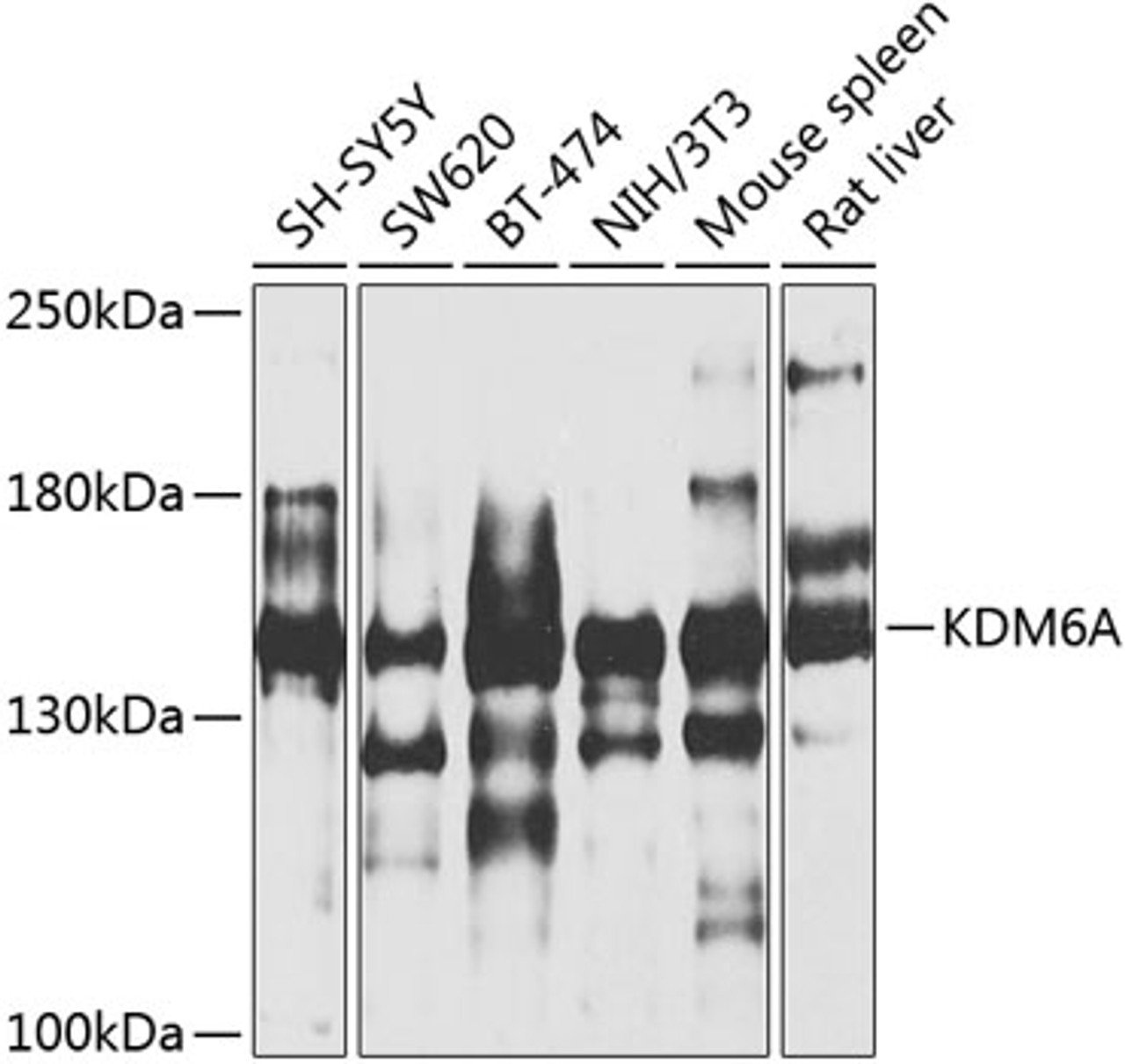 Western blot analysis of extracts of various cell lines, using KDM6A antibody (23-439) at 1:1000 dilution.<br/>Secondary antibody: HRP Goat Anti-Rabbit IgG (H+L) at 1:10000 dilution.<br/>Lysates/proteins: 25ug per lane.<br/>Blocking buffer: 3% nonfat dry milk in TBST.<br/>Detection: ECL Basic Kit.<br/>Exposure time: 40s.