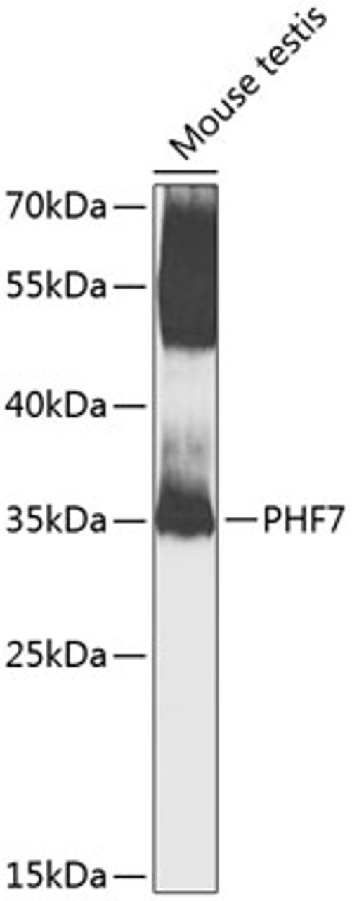 Western blot analysis of extracts of mouse testis, using PHF7 antibody (23-466) at 1:1000 dilution.<br/>Secondary antibody: HRP Goat Anti-Rabbit IgG (H+L) at 1:10000 dilution.<br/>Lysates/proteins: 25ug per lane.<br/>Blocking buffer: 3% nonfat dry milk in TBST.<br/>Detection: ECL Basic Kit.<br/>Exposure time: 90s.