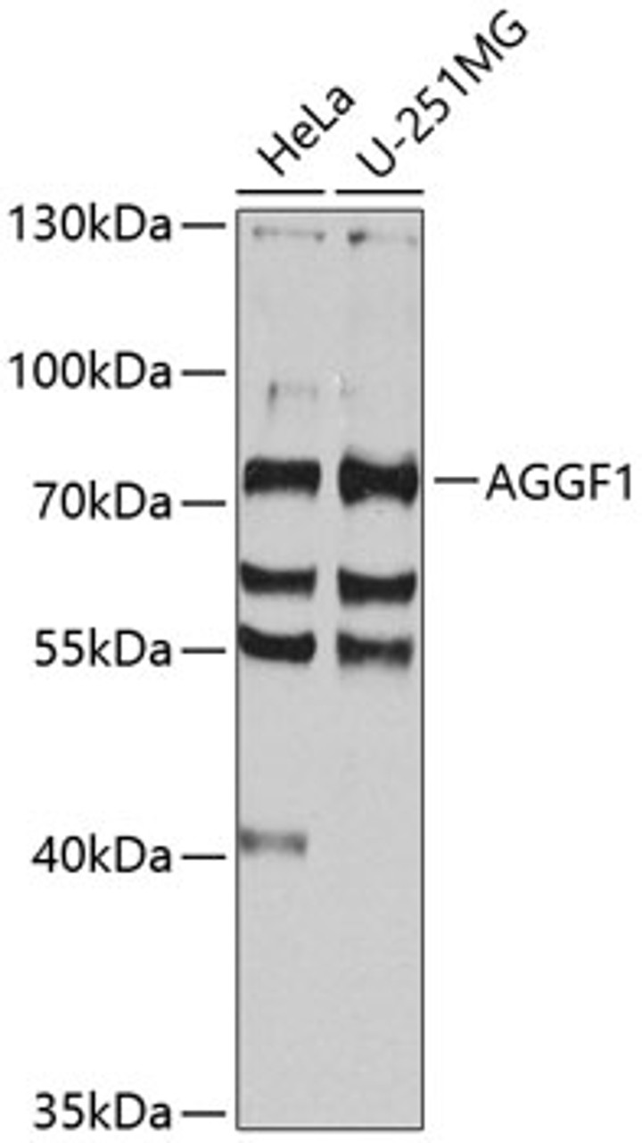 Western blot analysis of extracts of various cell lines, using AGGF1 antibody (23-471) at 1:1000 dilution.<br/>Secondary antibody: HRP Goat Anti-Rabbit IgG (H+L) at 1:10000 dilution.<br/>Lysates/proteins: 25ug per lane.<br/>Blocking buffer: 3% nonfat dry milk in TBST.<br/>Detection: ECL Basic Kit.<br/>Exposure time: 15s.