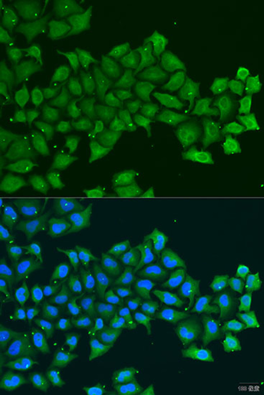 Immunofluorescence analysis of U2OS cells using PDGFD antibody (23-482) at dilution of 1:100. Blue: DAPI for nuclear staining.
