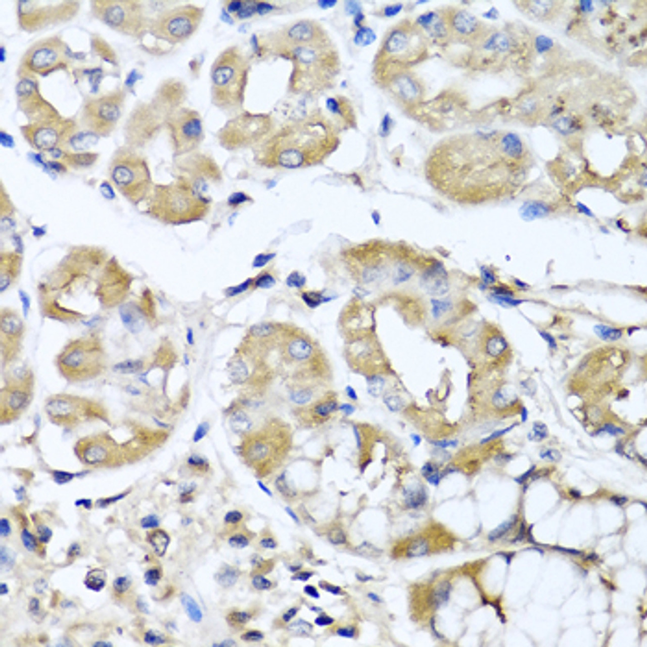 Immunohistochemistry of paraffin-embedded human stomach using IFNL1 antibody (23-491) at dilution of 1:100 (40x lens) .