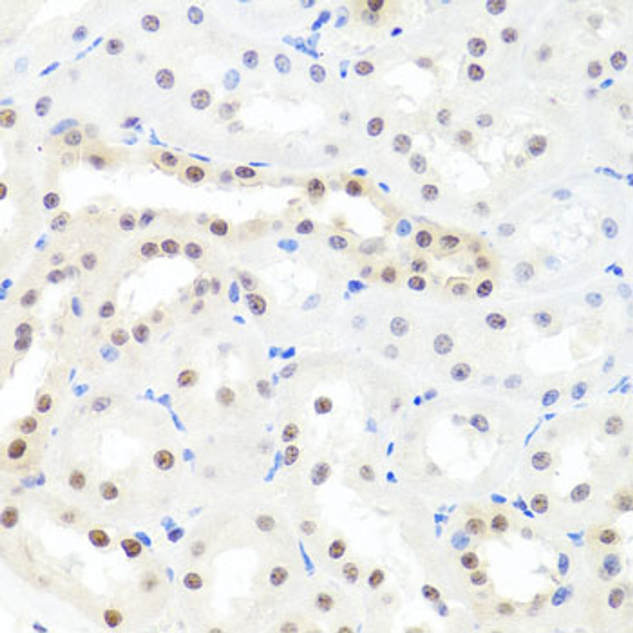 Immunohistochemistry of paraffin-embedded rat kidney using HNRNPCL1 antibody (23-686) at dilution of 1:100 (40x lens) .