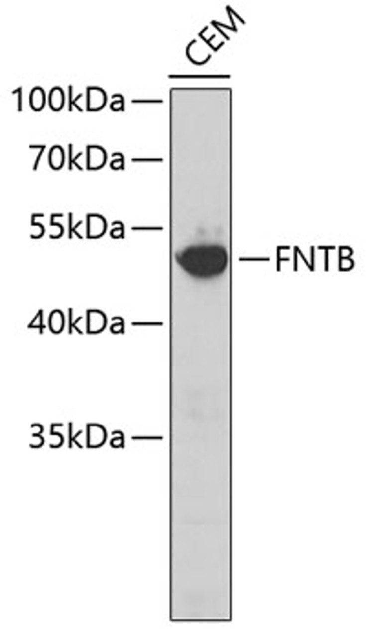 Western blot analysis of extracts of CEM cells, using FNTB antibody (23-706) .<br/>Secondary antibody: HRP Goat Anti-Rabbit IgG (H+L) at 1:10000 dilution.<br/>Lysates/proteins: 25ug per lane.<br/>Blocking buffer: 3% nonfat dry milk in TBST.