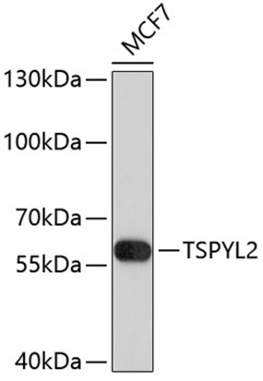 Western blot analysis of extracts of MCF-7 cells, using TSPYL2 antibody (23-723) .<br/>Secondary antibody: HRP Goat Anti-Rabbit IgG (H+L) at 1:10000 dilution.<br/>Lysates/proteins: 25ug per lane.<br/>Blocking buffer: 3% nonfat dry milk in TBST.