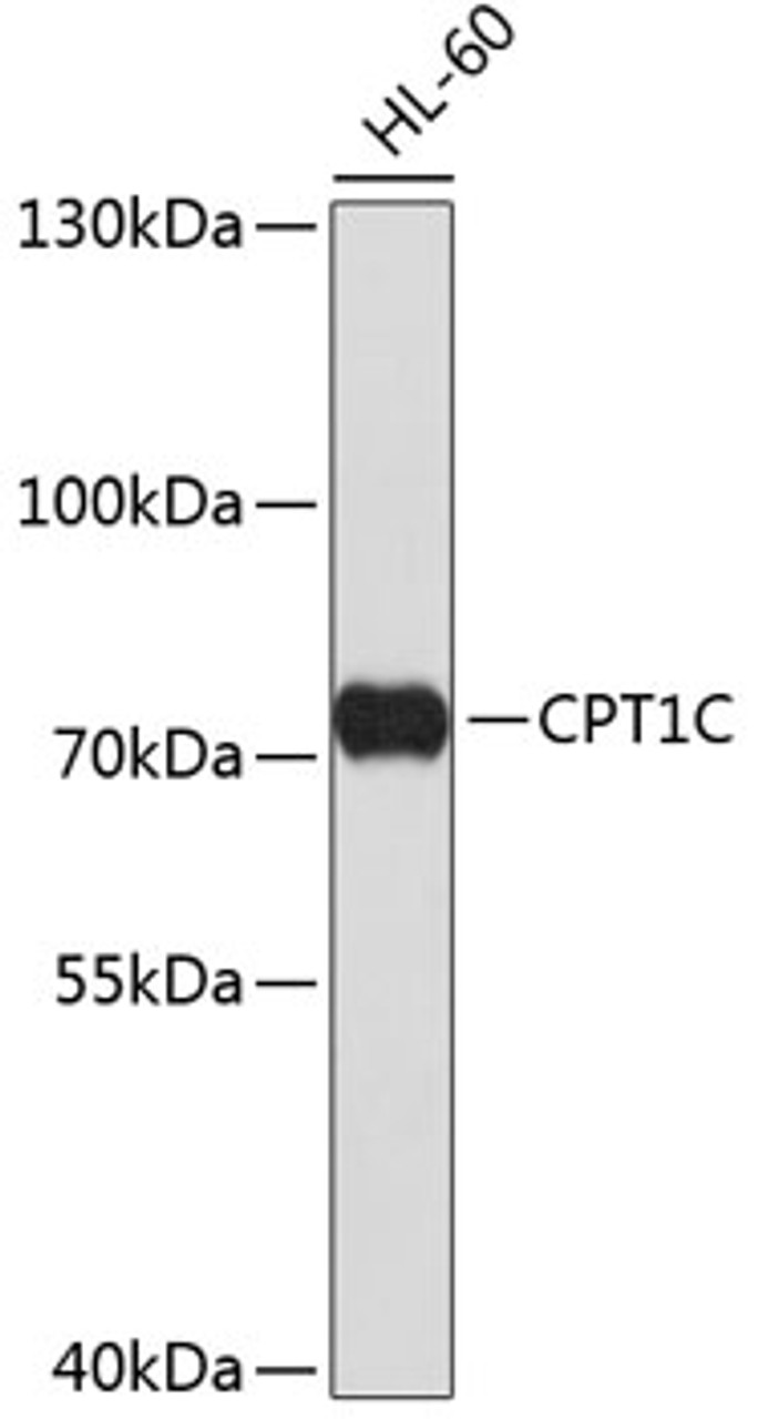 Western blot analysis of extracts of HL-60 cells, using CPT1C antibody (23-746) .<br/>Secondary antibody: HRP Goat Anti-Rabbit IgG (H+L) at 1:10000 dilution.<br/>Lysates/proteins: 25ug per lane.<br/>Blocking buffer: 3% nonfat dry milk in TBST.
