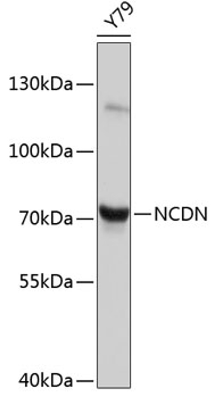 Western blot analysis of extracts of Y79 cells, using NCDN antibody (23-753) .<br/>Secondary antibody: HRP Goat Anti-Rabbit IgG (H+L) at 1:10000 dilution.<br/>Lysates/proteins: 25ug per lane.<br/>Blocking buffer: 3% nonfat dry milk in TBST.