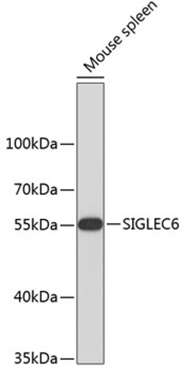 Western blot analysis of extracts of mouse spleen, using SIGLEC6 antibody (23-756) .<br/>Secondary antibody: HRP Goat Anti-Rabbit IgG (H+L) at 1:10000 dilution.<br/>Lysates/proteins: 25ug per lane.<br/>Blocking buffer: 3% nonfat dry milk in TBST.