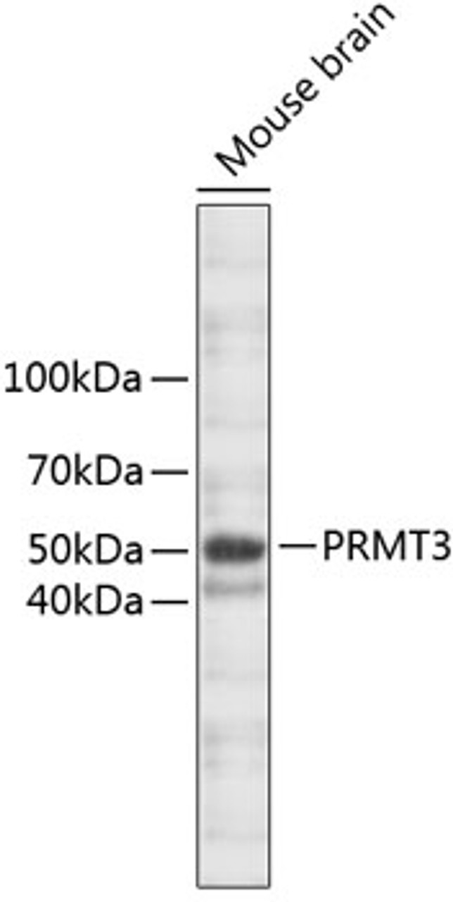 Western blot analysis of extracts of mouse brain, using PRMT3 antibody (23-828) .<br/>Secondary antibody: HRP Goat Anti-Rabbit IgG (H+L) at 1:10000 dilution.<br/>Lysates/proteins: 25ug per lane.<br/>Blocking buffer: 3% nonfat dry milk in TBST.