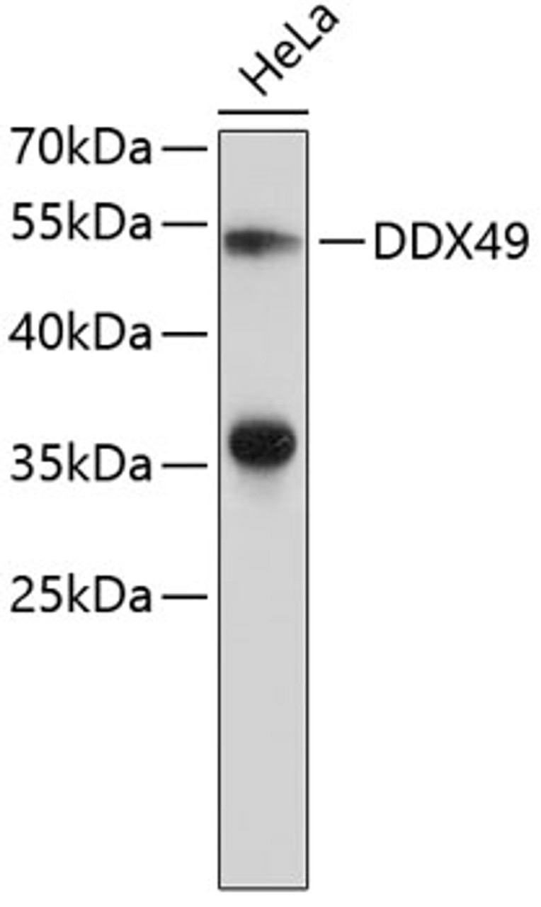 Western blot analysis of extracts of HeLa cells, using DDX49 antibody (23-856) .<br/>Secondary antibody: HRP Goat Anti-Rabbit IgG (H+L) at 1:10000 dilution.<br/>Lysates/proteins: 25ug per lane.<br/>Blocking buffer: 3% nonfat dry milk in TBST.