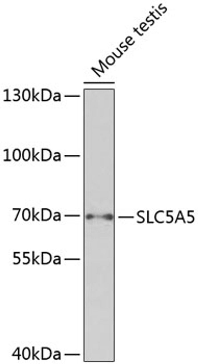 Western blot analysis of extracts of mouse testis, using SLC5A5 antibody (23-887) .<br/>Secondary antibody: HRP Goat Anti-Rabbit IgG (H+L) at 1:10000 dilution.<br/>Lysates/proteins: 25ug per lane.<br/>Blocking buffer: 3% nonfat dry milk in TBST.