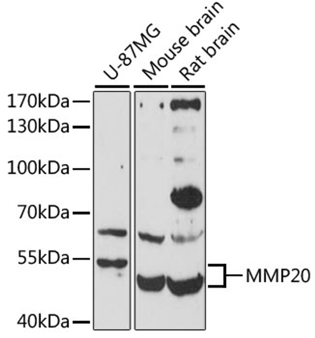 Western blot analysis of extracts of various cell lines, using MMP20 antibody (23-905) at 1:3000 dilution.<br/>Secondary antibody: HRP Goat Anti-Rabbit IgG (H+L) at 1:10000 dilution.<br/>Lysates/proteins: 25ug per lane.<br/>Blocking buffer: 3% nonfat dry milk in TBST.<br/>Detection: ECL Enhanced Kit.<br/>Exposure time: 90s.