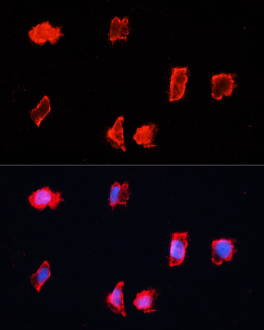 Immunofluorescence analysis of HeLa cells using BST1 antibody (23-965) at dilution of 1:100. Blue: DAPI for nuclear staining.