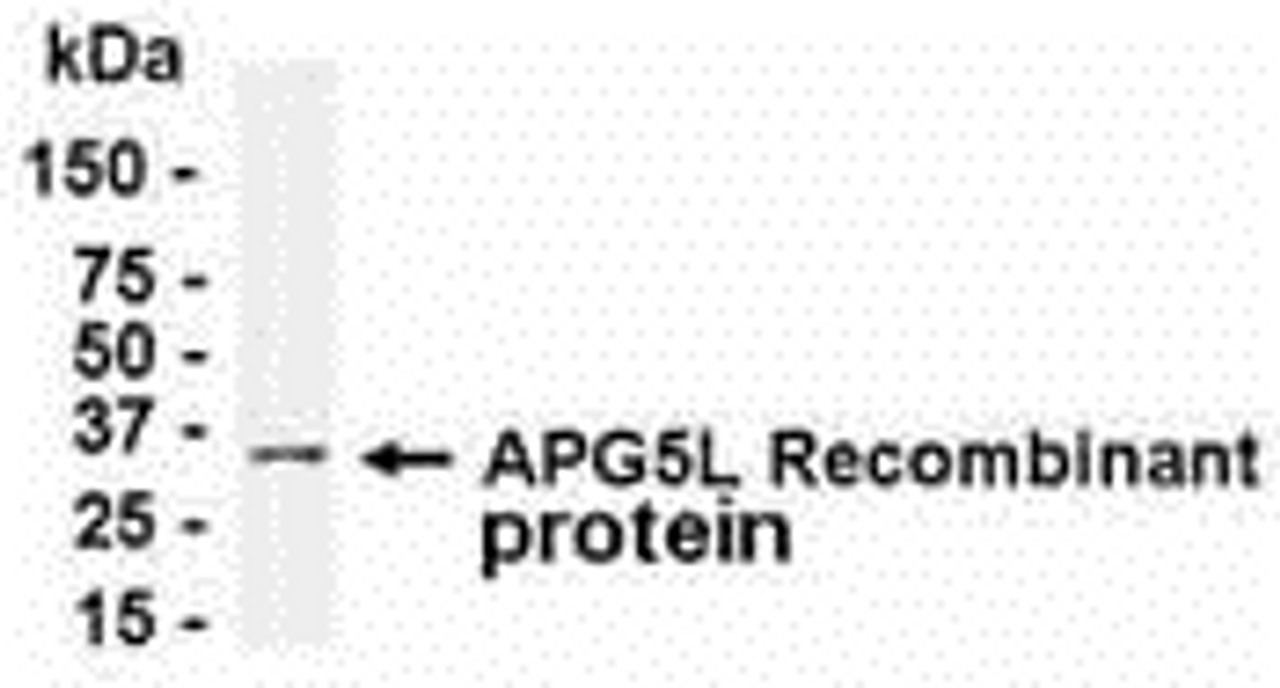 E coli-derived recombinant protein as test antigen. Affinity-purified IgY dilution: 1:2000, Goat anti-IgY-HRP dilution: 1:1000. Colorimetric method for signal development.