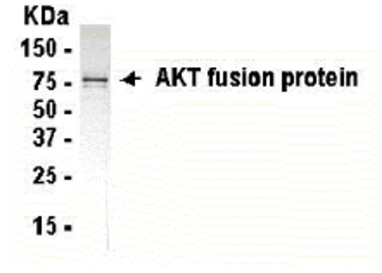 Western Blot: XW-7019 dilution: 1:2, 000. Goat anti-13990-HRP dilution: 1:1, 000. E coli-derived fusion protein as test antigen.