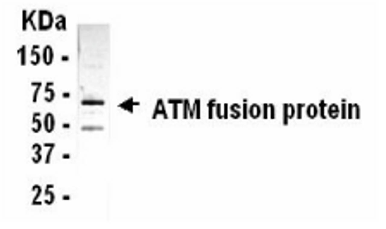 Western blot analysis of an E. coli derived ATM fusion protein using XW-7045 at a 1:2, 000 dilution. The fusion protein contained only a domain of 85 amino acids. The fusion partner is about 53kDa. The fusion protein size is approximately 63kDa.