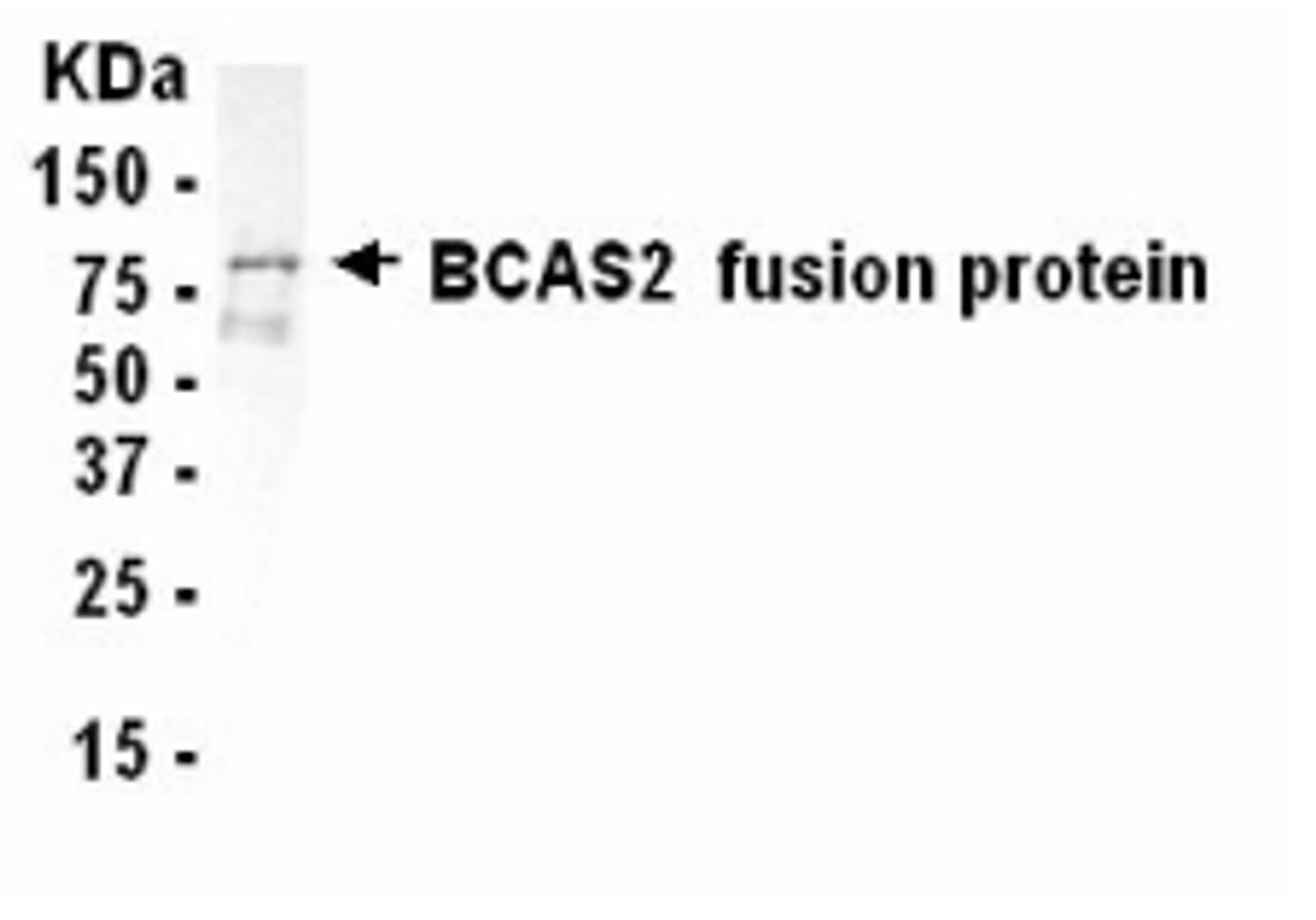 Western Blot: E coli-derived fusion protein as test antigen. XW-7054 dilution: 1:2, 000.