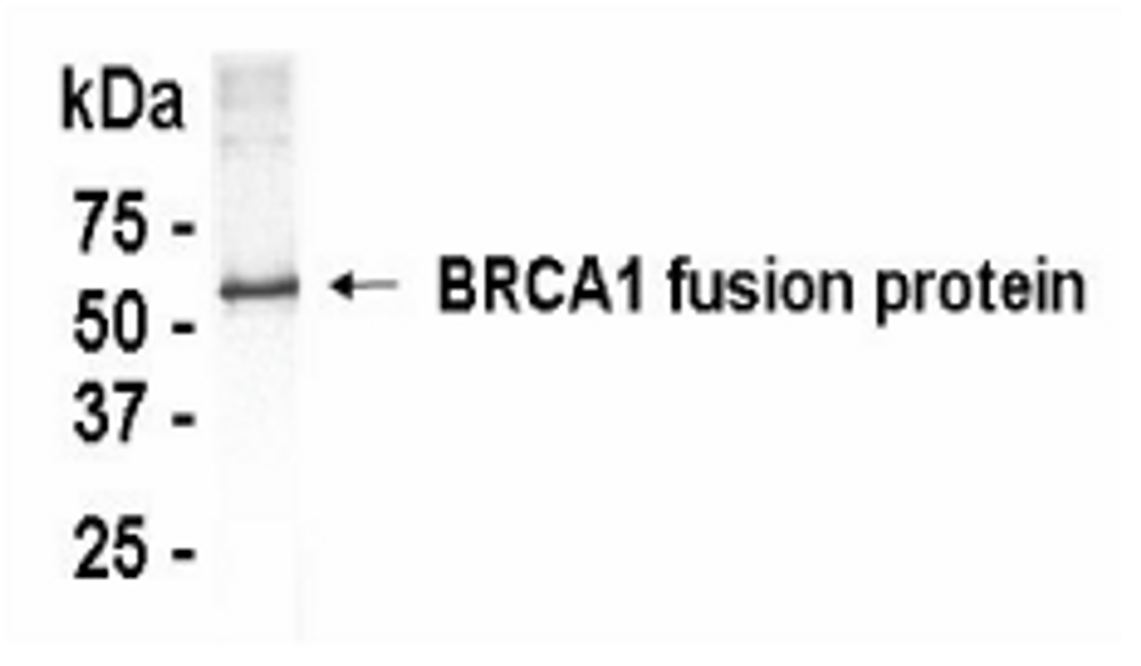 Western Blot: XW-7058 at a 1:2, 000 dilution. E.coli derived human BRCA1 fusion protein as test antigen.