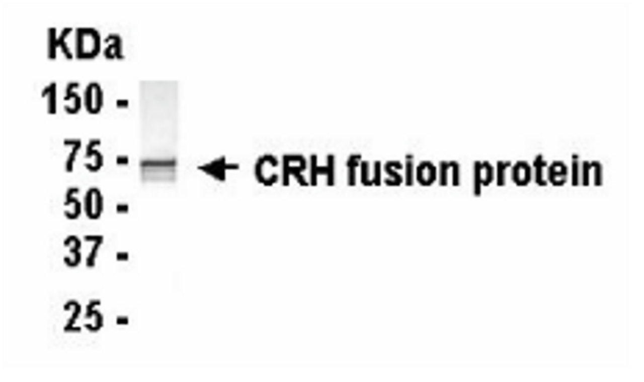 Western Blot: E coli-derived fusion protein as test antigen. XW-7122 dilution: 1:2, 000.