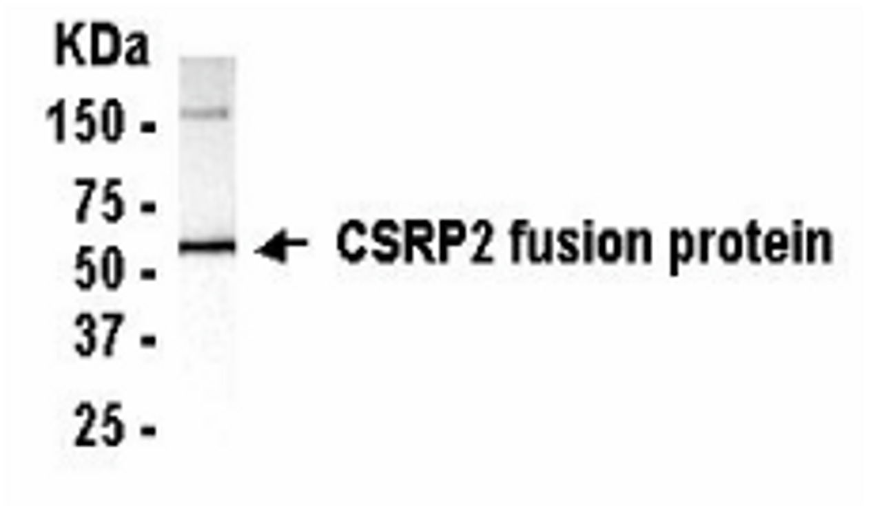 Western Blot: E coli-derived fusion protein as test antigen. XW-7127 dilution: 1:2, 000, Goat anti-IgY-HRP dilution: 1:1, 000.