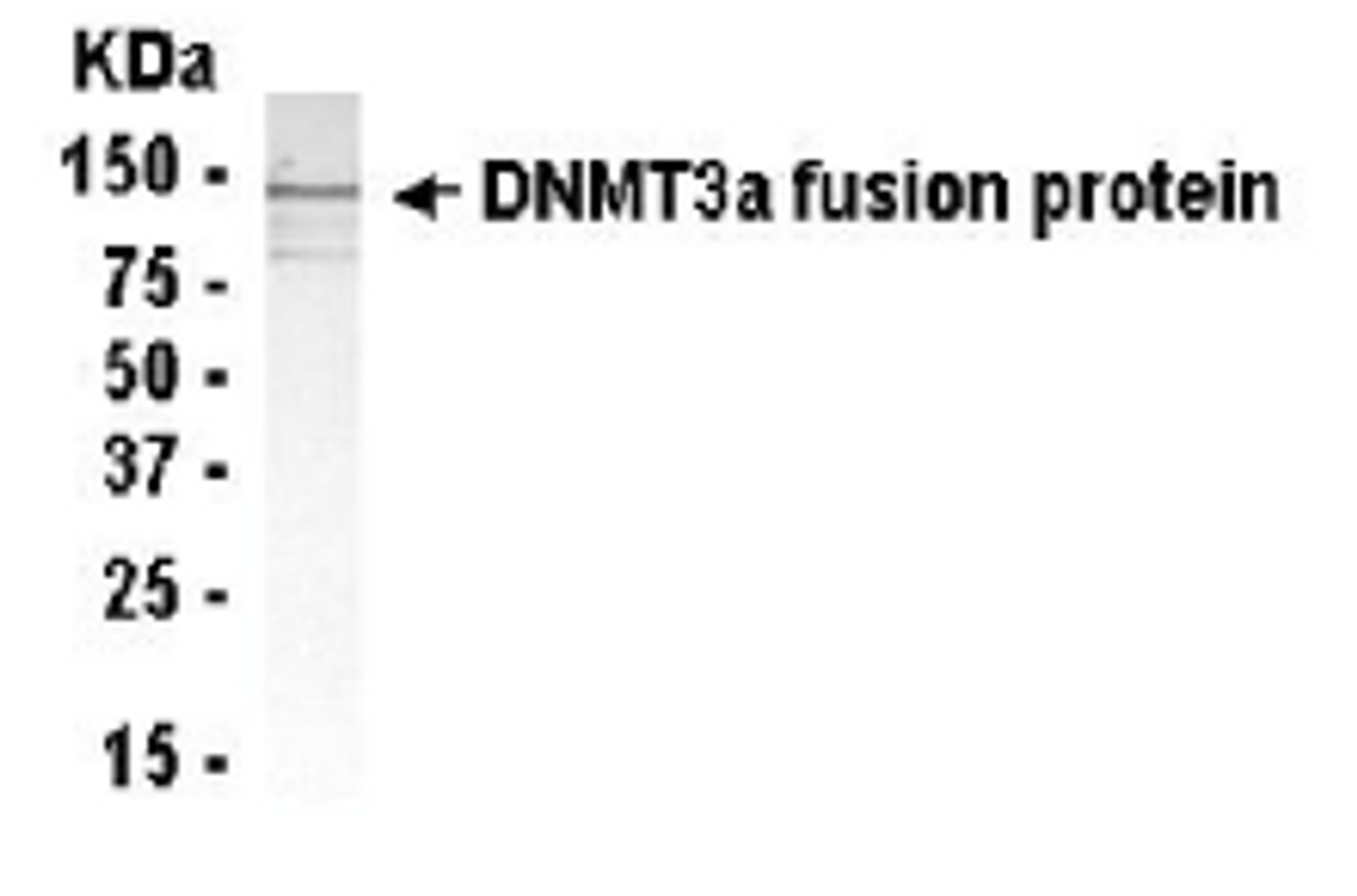 Western Blot: Anti-Dnmt3a antibody XW-7148 at 1/2000 dilution + E.coli. derived Dnmt3a fusion protein. Secondary: HRP conjugated goat anti IgY at 1/1000 dilution. Predicted band size : 109 kDa